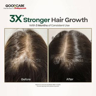 Goodcare Root Boost Hibiscus & Bhringhraj Hair Oil 100ml